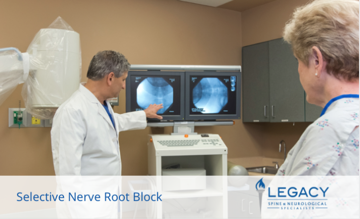 selective nerve root block