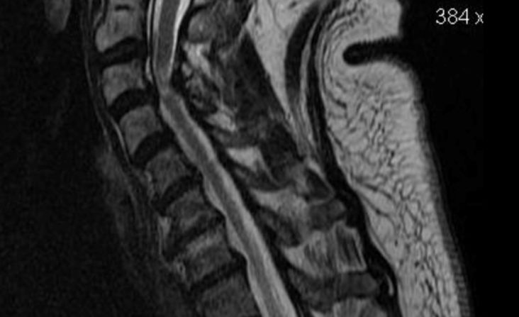 MRI Image